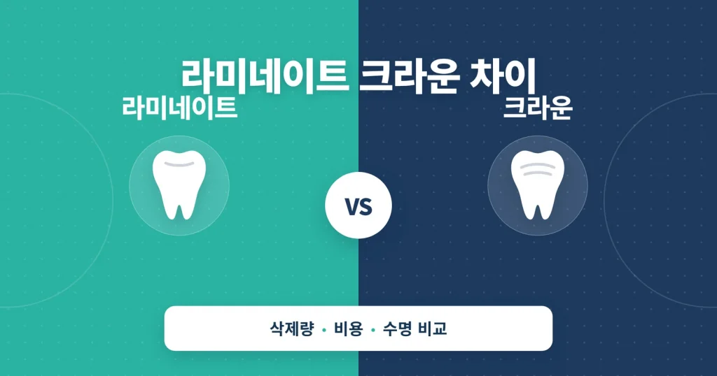 라미네이트 크라운 차이 정보 썸네일